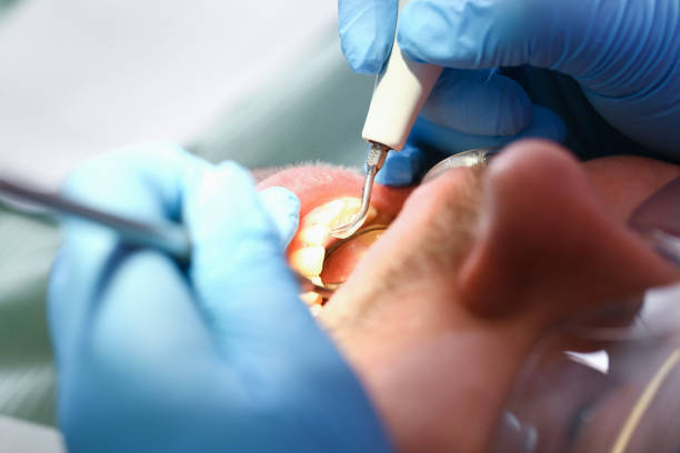 Best Emergency Root Canal Treatment in Latrobe, PA